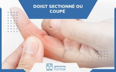 Le doigt sectionné ou coupé : symptômes, diagnostic et traitements