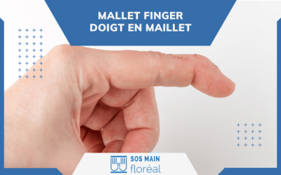Mallet finger : symptômes, diagnostic et traitements