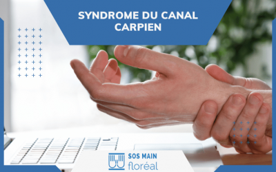 L’opération du syndrome du canal carpien