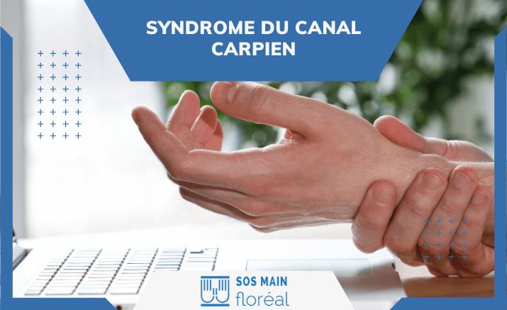 L’opération du syndrome du canal carpien