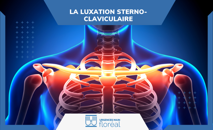 Luxation sterno-claviculaire