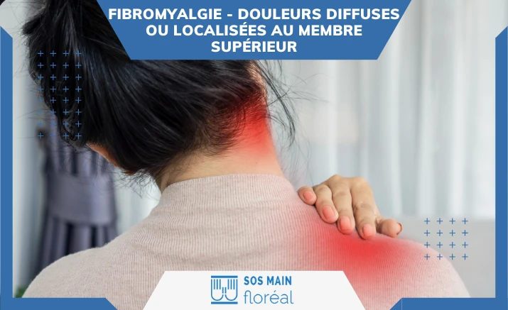 Douleurs diffuses ou localisées au membre supérieur : quand penser à la fibromyalgie ?