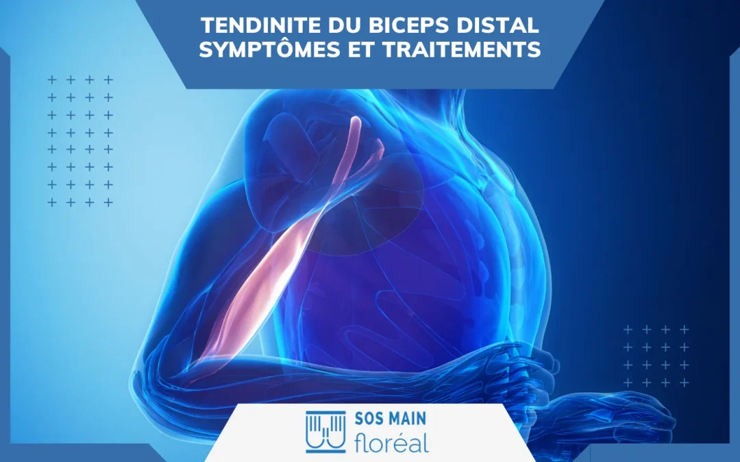 Tendinite du biceps distal : symptômes et traitements