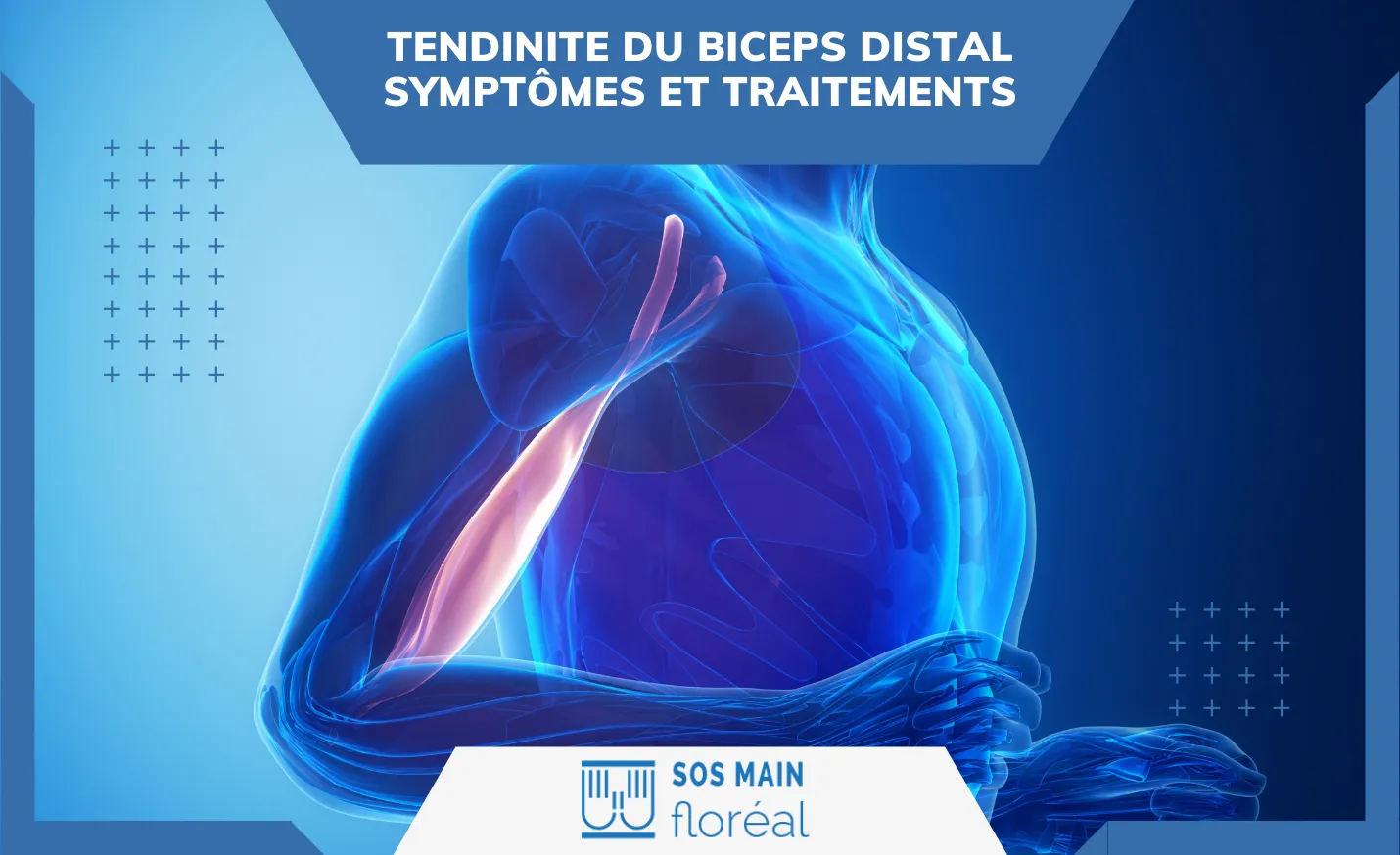Tendinite du biceps distal